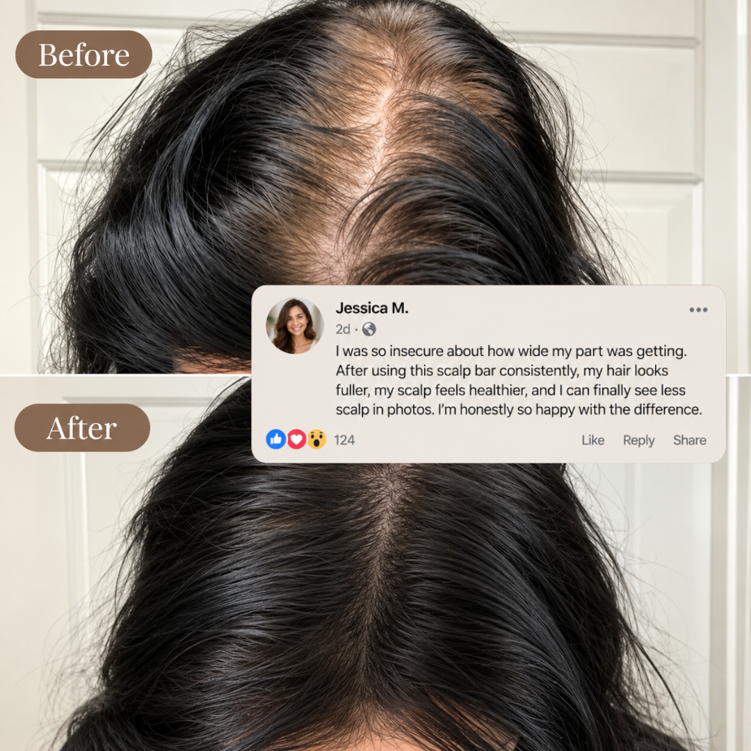 Scalp Revival Shampoo Bar